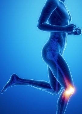 Arthrose: Ohne Training wird es schlimmer